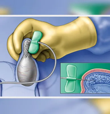 Service Image
